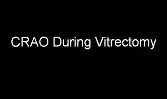 Central retinal artery occlusion during vitrectomy: Immediate retinal revascularization following PVD induction