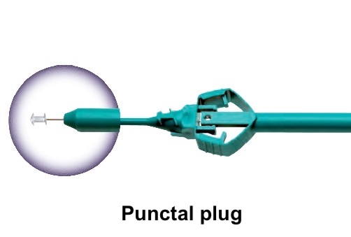 Punctal Plug FCI ophthalmics